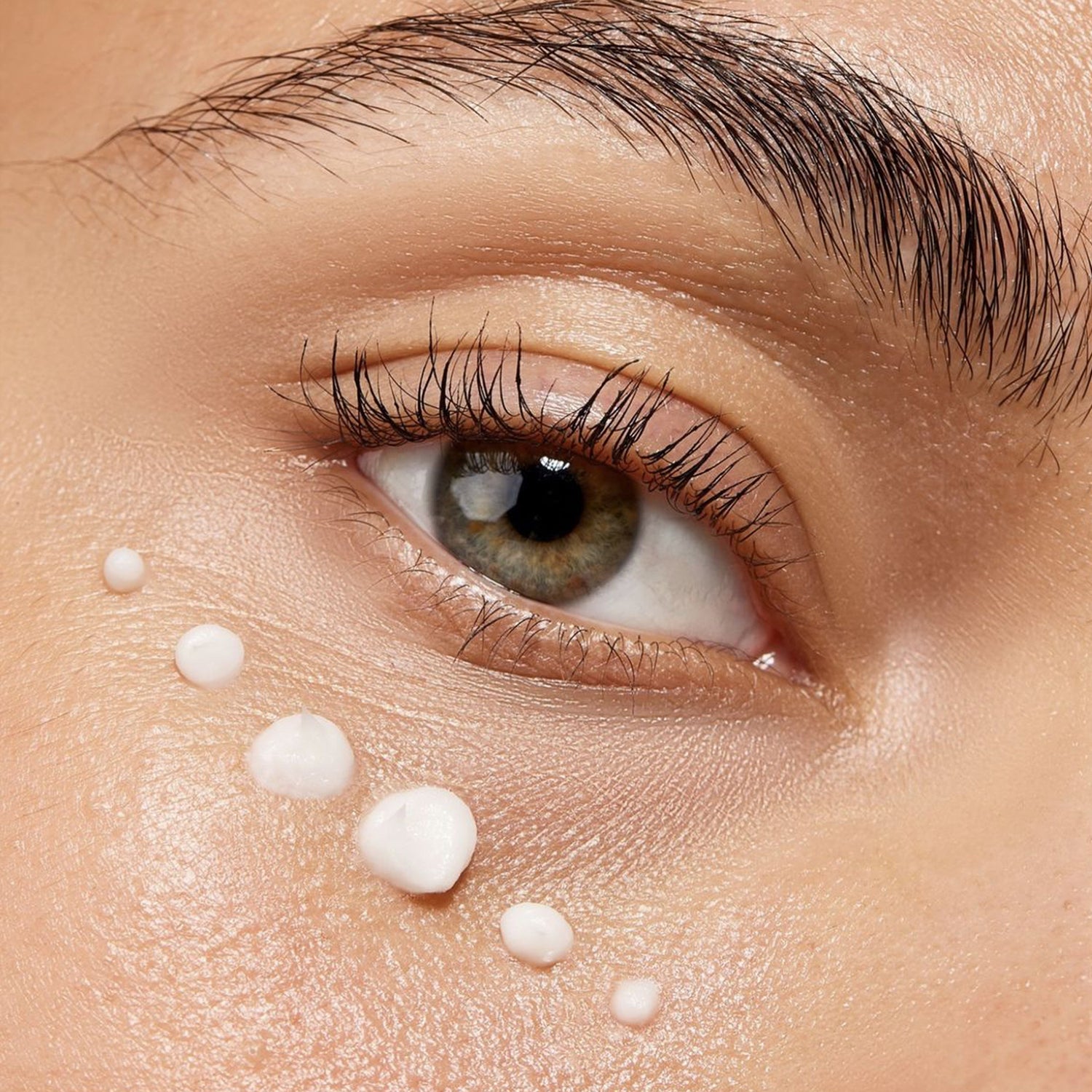 Why Dark Circles Form — Can Skincare Actually Fix Them?