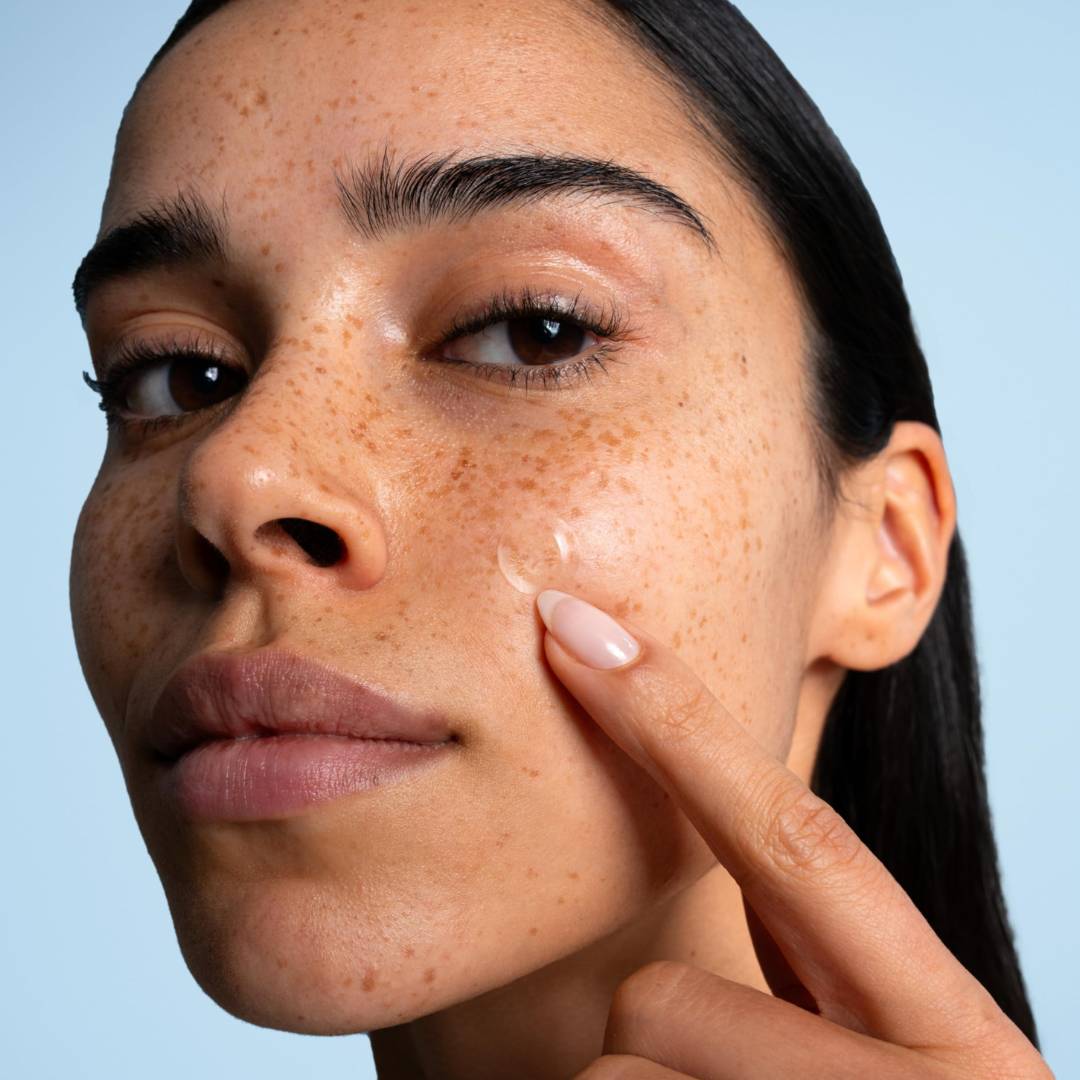 Dark spots can they fade in 3 days - no